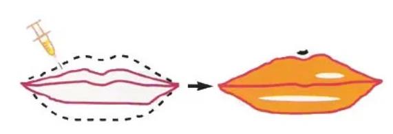 丰唇动漫3.jpg 丰唇动漫3.jpg