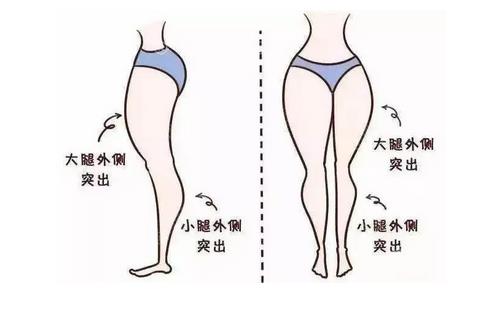 隔空减脂是什么?适合哪些人做?