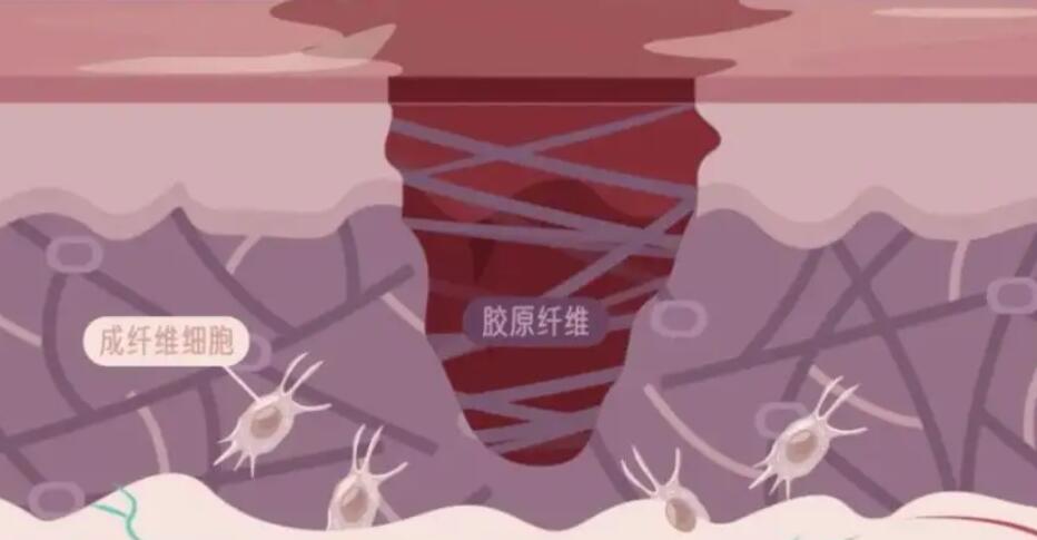 大腿祛疤动漫01.jpg