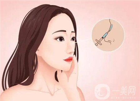 重庆星范丽格隆鼻怎么样？价格表实例图
