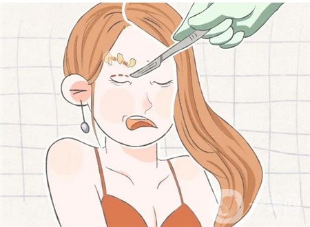 济南隅美整形医院怎么样?双眼皮真实实例和价格表一览