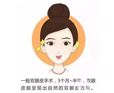 杭州格莱美医院做双眼皮咋样?实例价格表公开