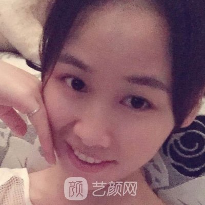 深圳柏伦口腔门诊部怎么样？全新种植牙实例出炉