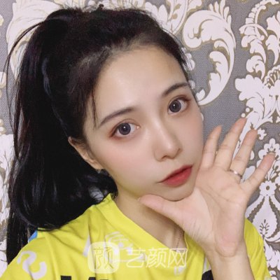 淄博壹美植发价格表公布｜内附全新体验实例