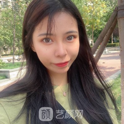 淄博壹美植发价格表公布｜内附全新体验实例