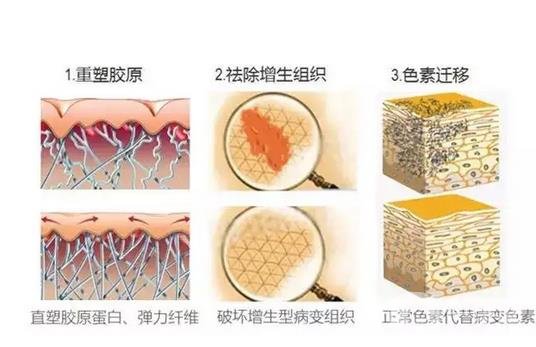 郑大二附院整形科去疤痕果咋样?实例果_2021价格表全览!