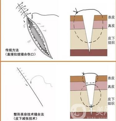 郑大二附院整形科去疤痕果咋样?实例果_2021价格表全览!