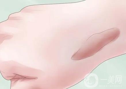 郑大二附院整形科去疤痕果咋样?实例果_2021价格表全览!