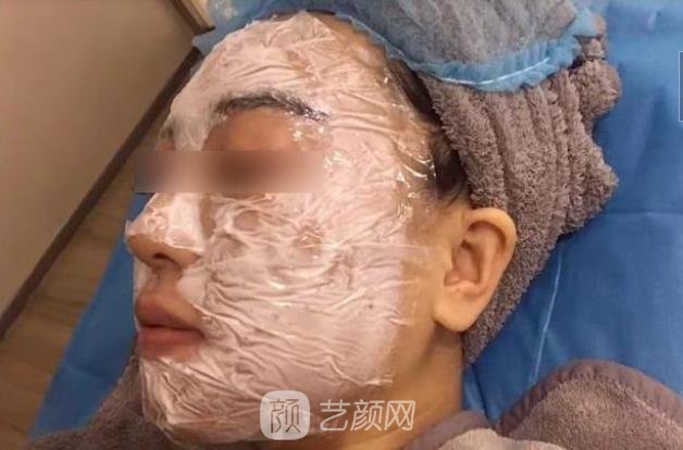 打水光针了图片真实实例，1-7天肤质变化很大