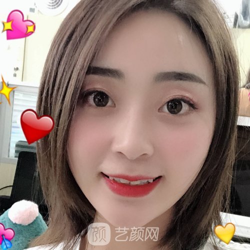 淄博佳美口腔医院怎么样？牙齿正畸实例及成果图出炉