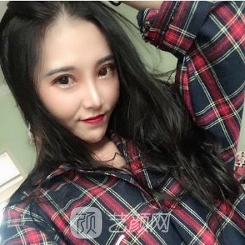 北京联合丽格郭树忠怎么样？教授简介+隆鼻实例图