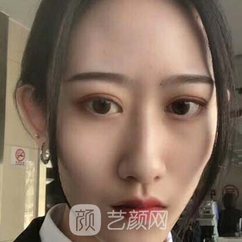万柳王瑛医美咋样？实力测评，彩光嫩肤实例反馈