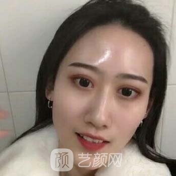 万柳王瑛医美咋样？实力测评，彩光嫩肤实例反馈