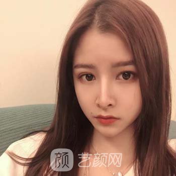 上海九院李青峰简介|医生技术实力怎么样？肋骨鼻实例