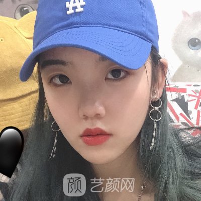 广州广大整形医院磨骨怎么样？医院实力及招牌实例曝光