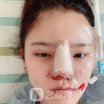 北京八大处整形医院宋涛医生技术怎么样？技术成就+隆鼻实例