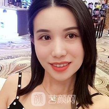 大韩美容协会胡朝晖医生怎么样？详细简介+双眼皮实例