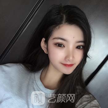 丁合军简介怎么样？医生详细资料+双眼皮整形实例