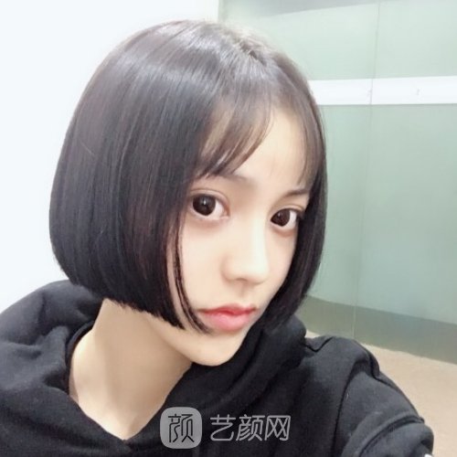 广州熙朵医疗美容医院怎么样？2022植发实例公布