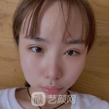 呼和浩特闫小林美容院现在还是闫小林主刀吗？医生简介+真人实例