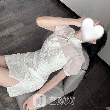 郑州大学第一附属医院私密整形科靠谱吗?2022阴唇漂红实例出炉