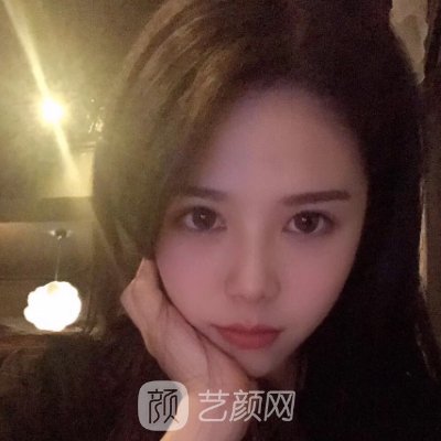 石家庄恩喜整形医院做双眼皮多少钱？新版收费标准及实例展示