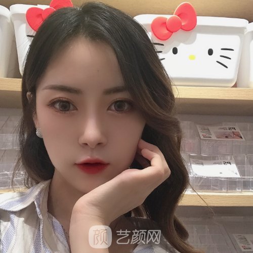 扬州施尔美去眼袋多少钱？崭新收费标准及实例分享
