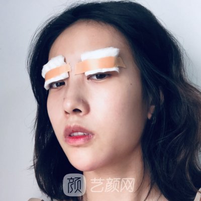 广州越秀紫馨曹仁昌修复眼睛真的厉害吗？？2022招牌实例公开