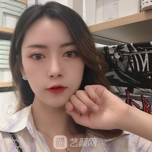 上海九院王涛隆鼻怎么样？医生招牌实例公开