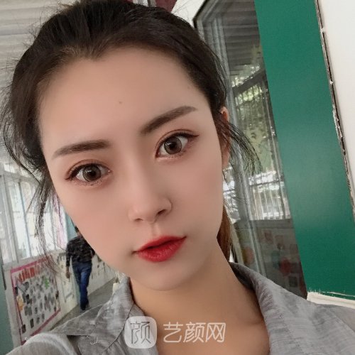 上海九院王涛隆鼻怎么样？医生招牌实例公开