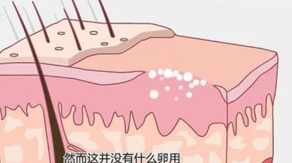 疤痕修复动漫2.jpg 疤痕修复动漫2.jpg