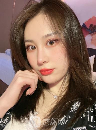 广州恒美整形医院怎么样？做鼻子好吗？简介+隆鼻实例