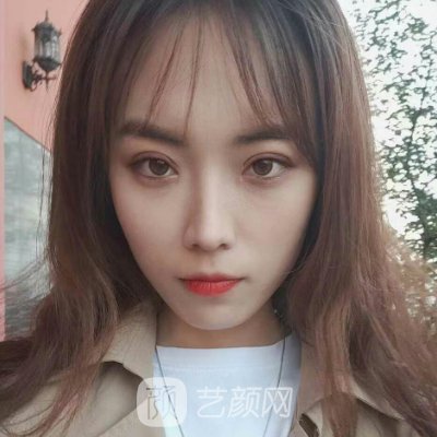 北京医院双眼皮价目表更新|内含医院招牌实例