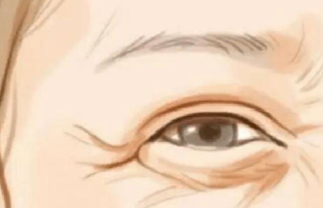 除皱动漫98.jpg 除皱动漫98.jpg