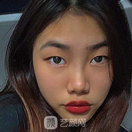 上海久雅整形医院怎么样?医院招牌嫩肤美白实例分享