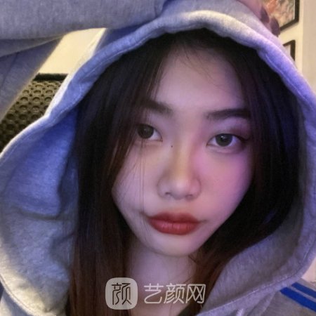 上海久雅整形医院怎么样?医院招牌嫩肤美白实例分享