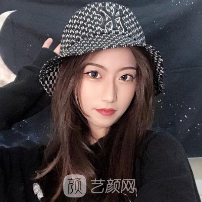 第四军医大学美容整形科怎么样?瘦脸针一周变化图展示