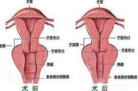 私密整形04.jpg