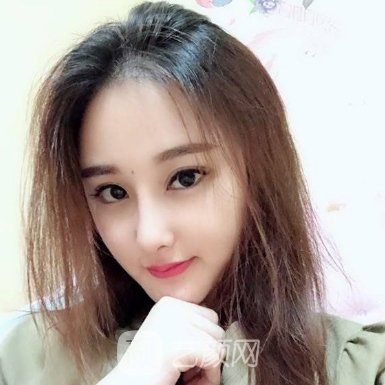 上海星美姿医疗美容医院隆鼻实例展示|亲身修复细节分享