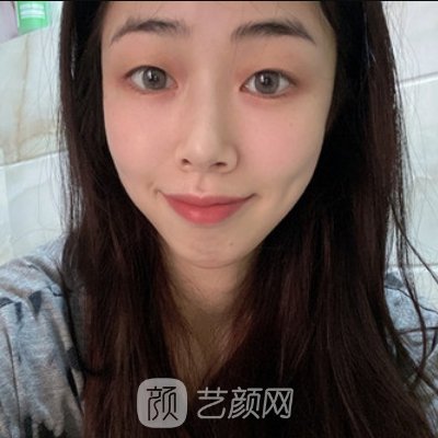 东莞美立方美容医院做鼻子怎样?医院招牌案例出炉