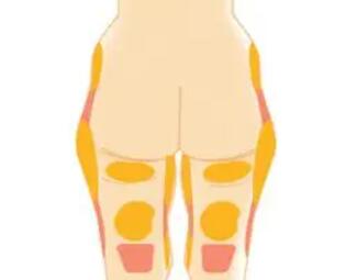 大腿吸脂动漫10.jpg