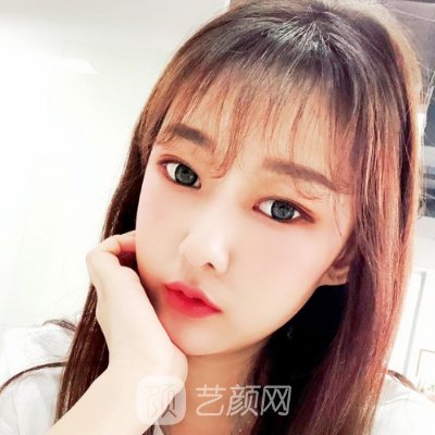 广西医科大一附院整形科瘦脸实例展示｜前后对比成果让人惊讶