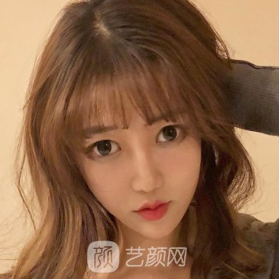 广西医科大一附院整形科瘦脸实例展示｜前后对比成果让人惊讶