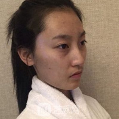 扬州施尔美整形医院是正规医院吗？医院嫩肤除皱实例出炉