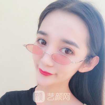 西京医院整形科双眼皮价格贵吗？官网价目表及实例一览