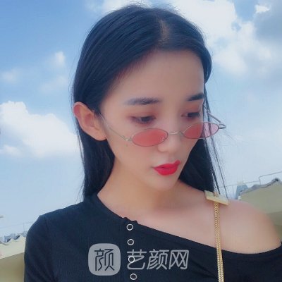 西京医院整形科双眼皮价格贵吗？官网价目表及实例一览