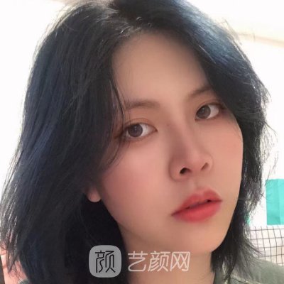 湘雅二医院植发价格表公开｜官网收费标准及实例展示