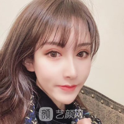 广东美恩张勇做鼻子风格公开|内附真人体验感悟