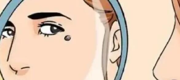 祛痣动漫13.jpg 祛痣动漫13.jpg