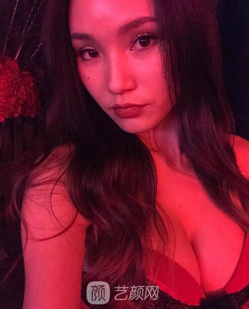 上海华美谢卫国隆胸实例，身材凹凸有致，魅力大增